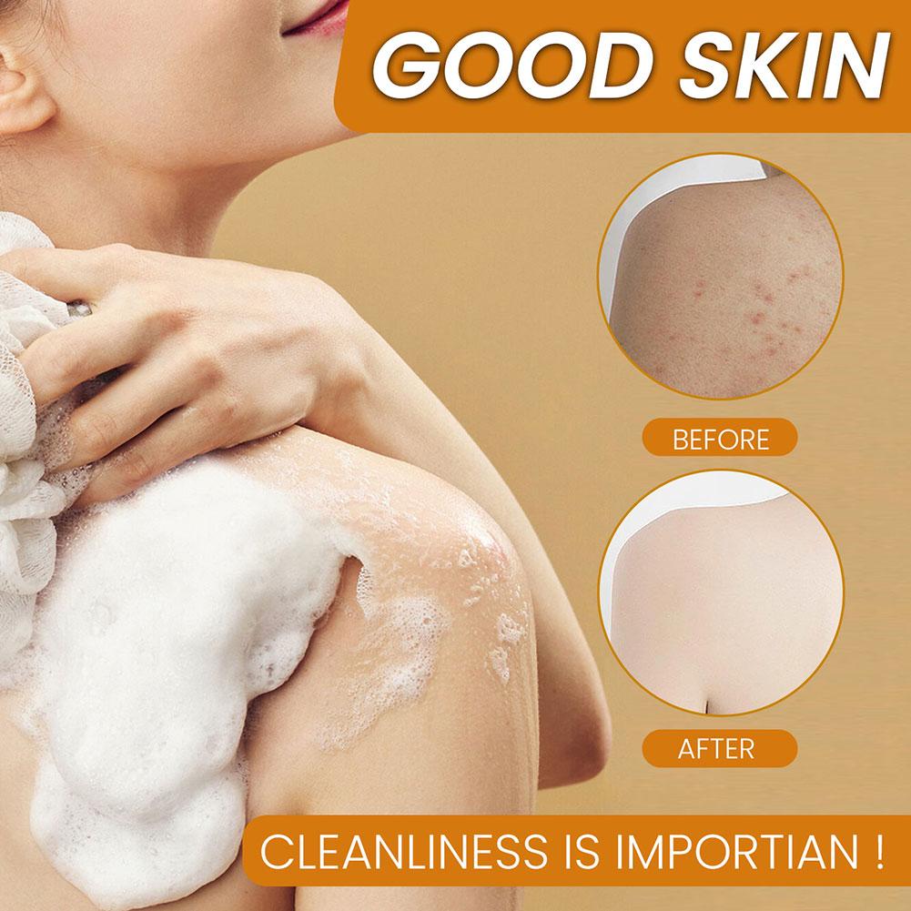 100g Turmeric Hand Made Soap, Lemon Kojic Acid Soap, Shower and Facial Soap  Deep Cleaning For Face Body Skin Care