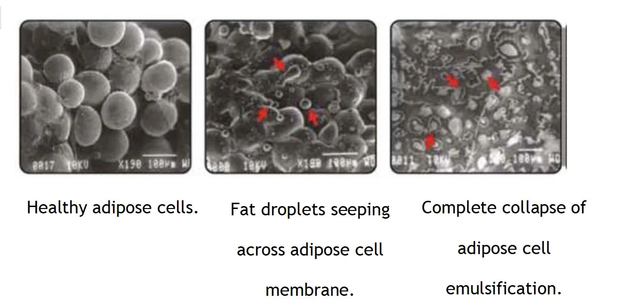 جهاز LuxMaster Emerald Laser Slim 2025 لعلاج فقدان الدهون في الجسم باستخدام ليزر 10D للصحة والعافية