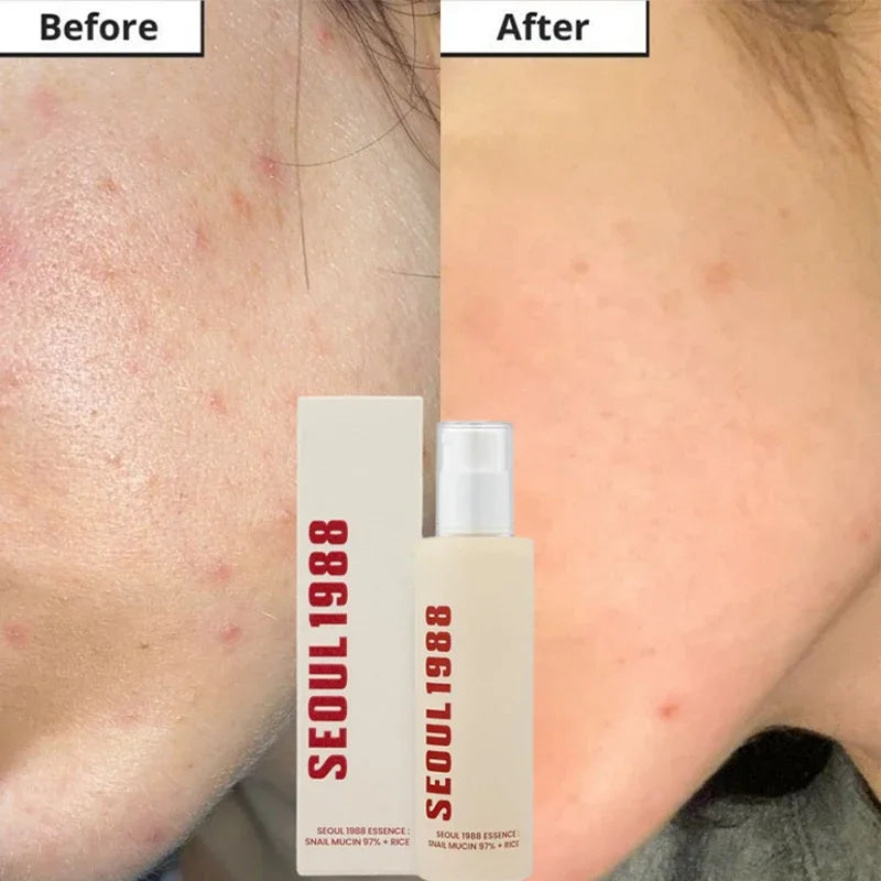 Korean Skin Care Set Seoul 1988 Eye Cream Snail Mucin Skincare Set Facial Sunscreen Cream Vitamin C Moisturizing Firming Essence