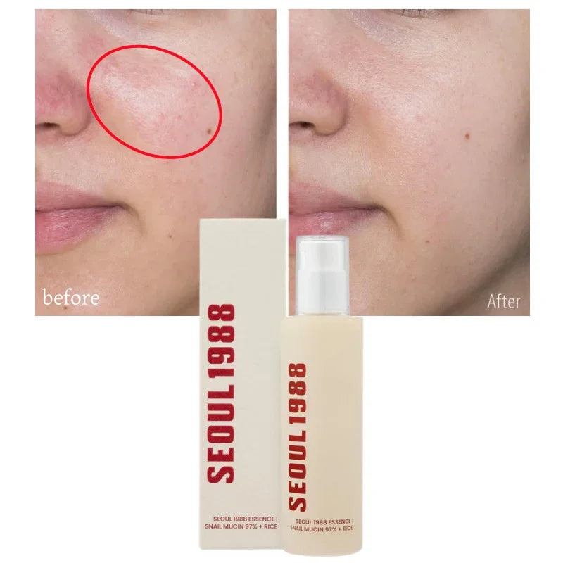 Korean Skin Care Set Seoul 1988 Eye Cream Snail Mucin Skincare Set Facial Sunscreen Cream Vitamin C Moisturizing Firming Essence