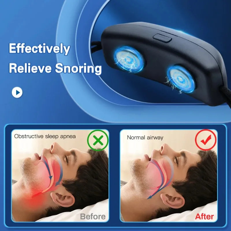 جهاز EMS Pulse Stop Snore المحمول المريح للنوم الجيد وإيقاف الشخير والعناية الصحية ومساعد توقف التنفس أثناء النوم وجهاز USB الذكي المضاد للشخير