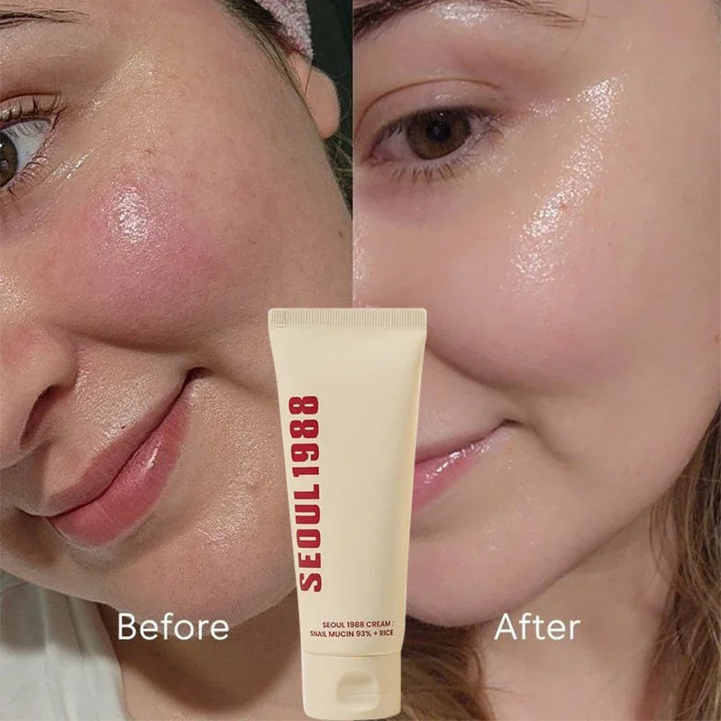 Korean Skin Care Set Seoul 1988 Eye Cream Snail Mucin Skincare Set Facial Sunscreen Cream Vitamin C Moisturizing Firming Essence