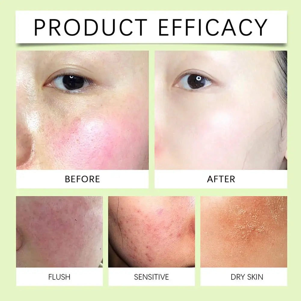 جل سنتيلا اسياتيكا المرطب والمهدئ للوجه، جل ترطيب عميق وإصلاح للعناية بالبشرة للنساء