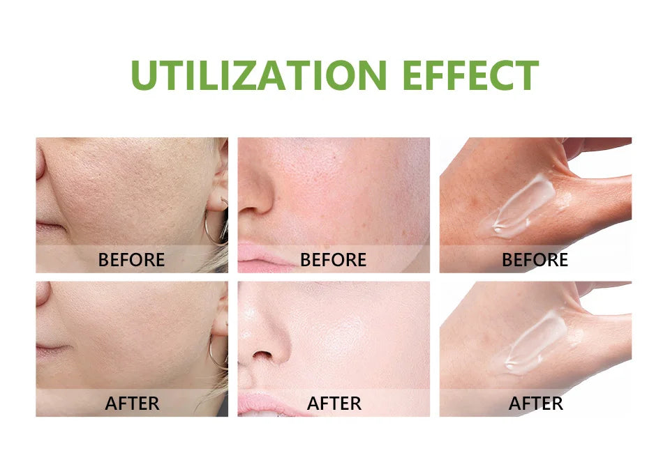 كريم ترطيب الوجه من Bubbles للعناية بالبشرة، كريم ترطيب الوجه من Bubbles، كريم تبييض البشرة الأصلي من Niacinist للعناية الشخصية والجمال