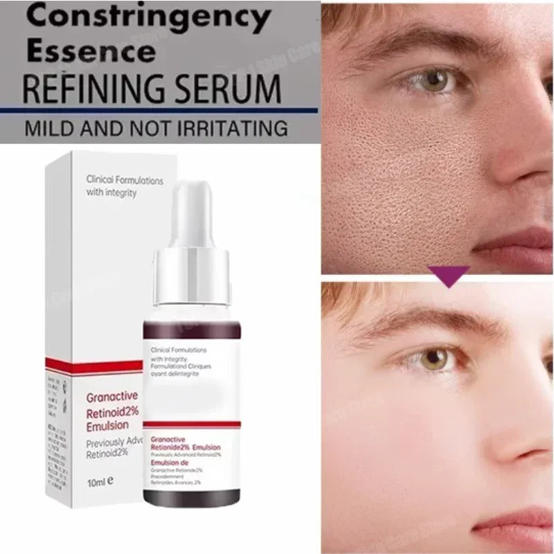 26 Skin Care Essence Minimizing Facial Pore Repairing Beauty Serum for Smoothing and Tightening Face; Minimize Pores