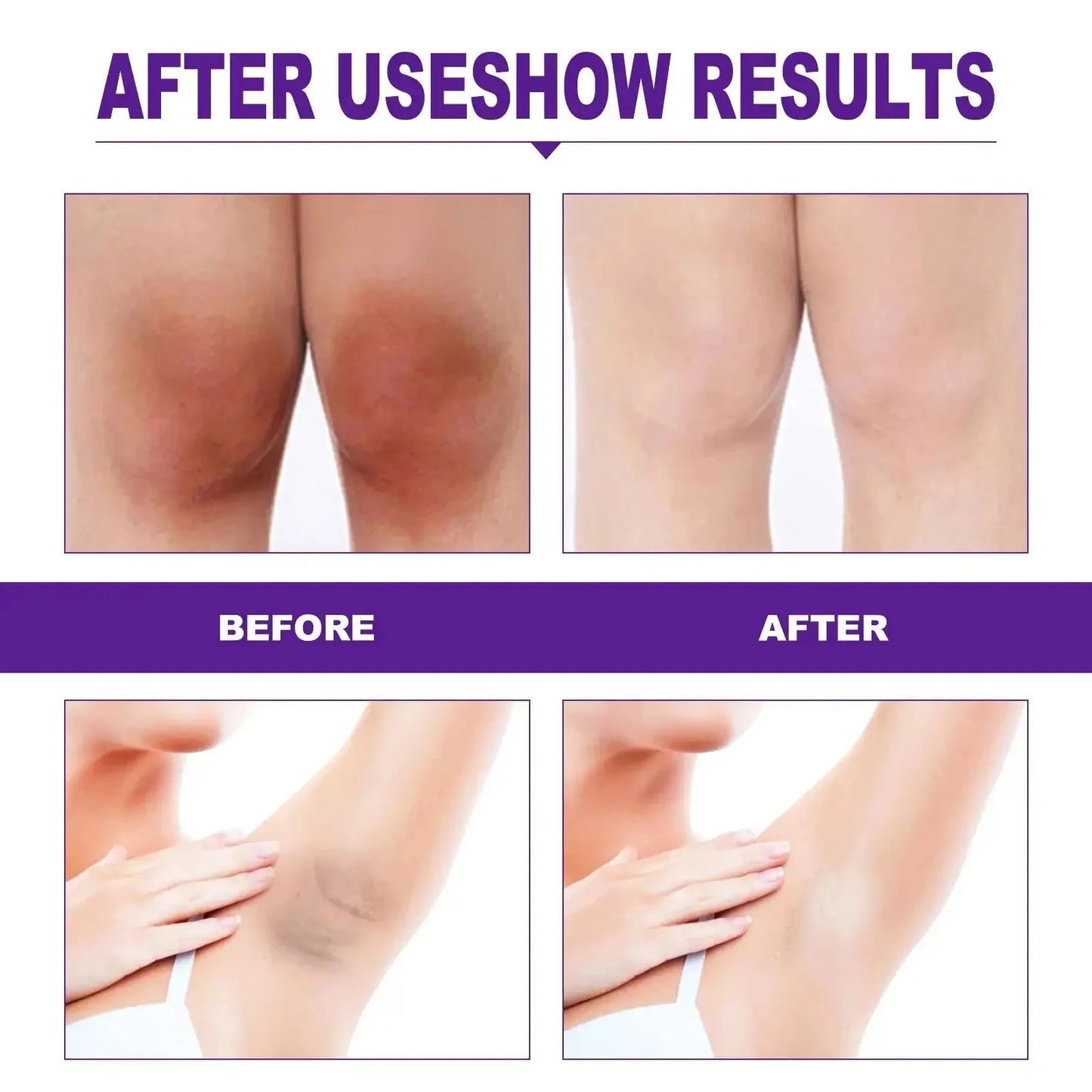 كريم تبييض المناطق الحساسة للجسم، مصل الجسم الوردي، تفتيح الميلانين، تحت الإبطين، الوركين، الفخذين الداخليين، تفتيح وإصلاح العناية بالأجزاء الخاصة