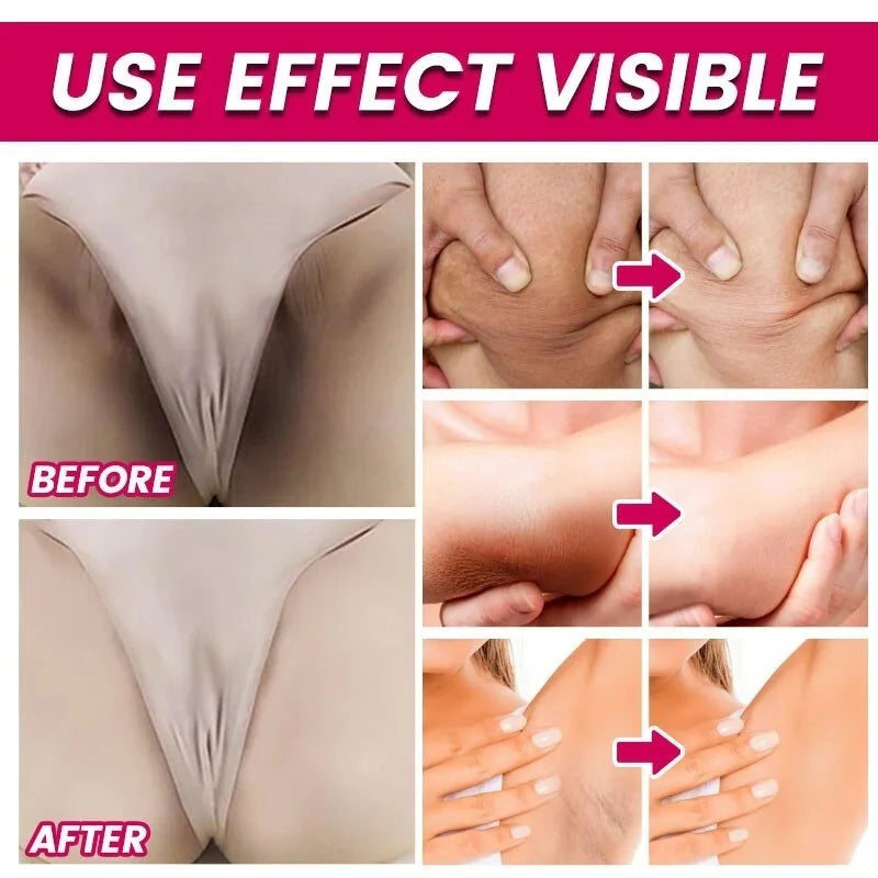 كريم تبييض المناطق الحساسة للجسم، مصل الجسم الوردي، تفتيح الميلانين، تحت الإبطين، الوركين، الفخذين الداخليين، تفتيح وإصلاح العناية بالأجزاء الخاصة