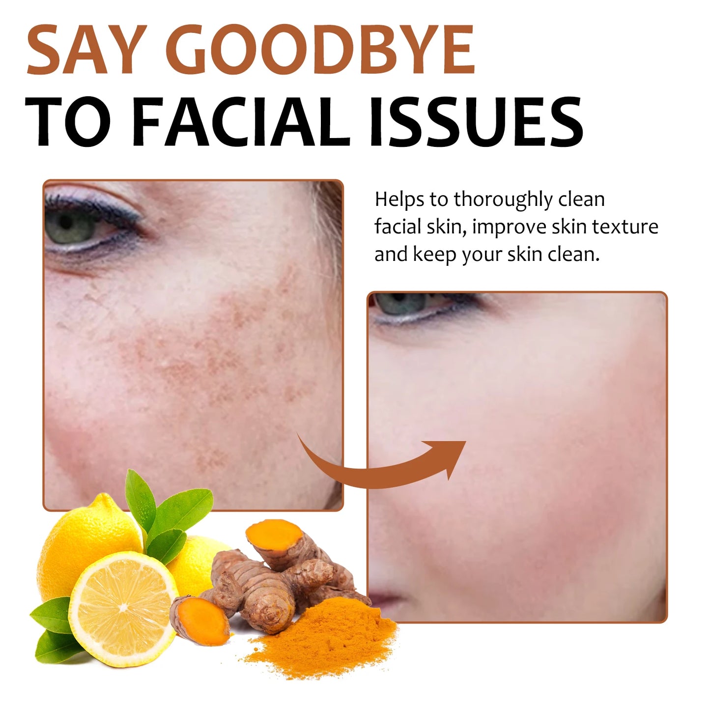 Facial Cleaning Handmade Soap Lemon Turmeric Kojic Acid Soap Deeply Cleansing Exfoliating Even Skin Tone Bathing Soap Skincare