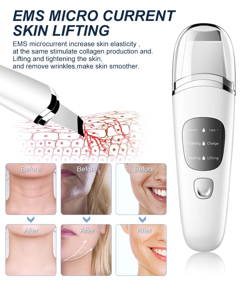 Personal Care Face Exfoliating Device Deep Cleansing Ultrasonic Face Spatula Facial Skin Scrubber