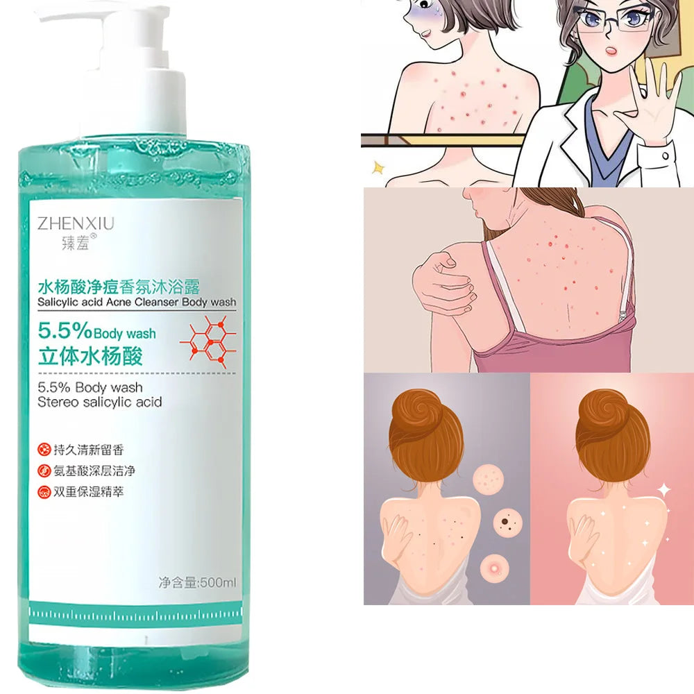 16.9 oz Salicylic Acid Body Wash, Gentle & Smoothing  Mild Exfoliating Daily Acne Body Wash Deep Cleanses Back Acne and Sebum SwiftNest