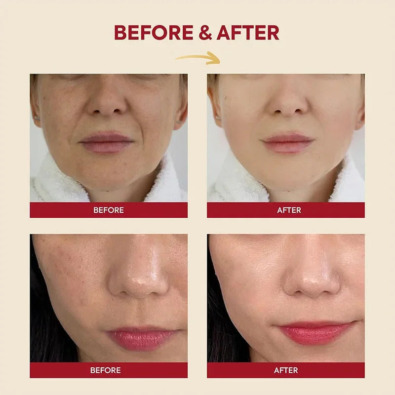 Korean Skin Care Set Seoul 1988 Eye Cream Snail Mucin Skincare Set Facial Sunscreen Cream Vitamin C Moisturizing Firming Essence