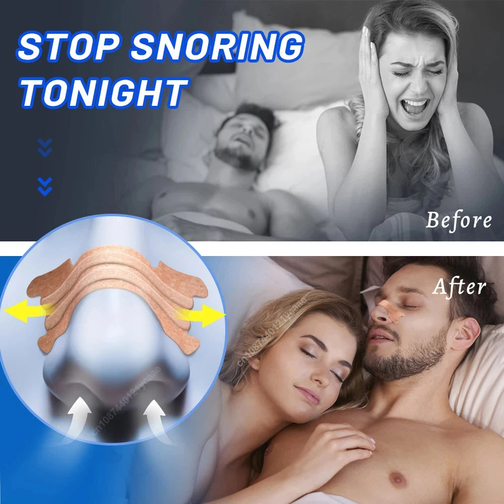 10/50/100pcs Breathing Nasal Strips Right Way Stop Snoring Anti Snoring Strips Easier Better Breathe Health Care Sleeping Well