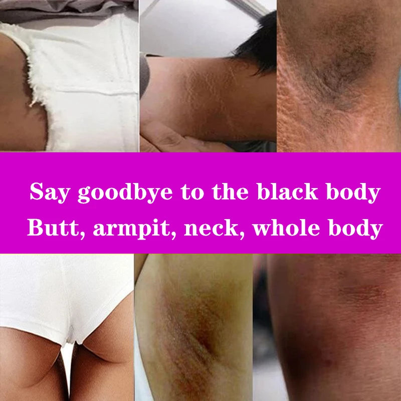 كريم تبييض المناطق الحساسة للجسم، مصل الجسم الوردي، تفتيح الميلانين، تحت الإبطين، الوركين، الفخذين الداخليين، تفتيح وإصلاح العناية بالأجزاء الخاصة
