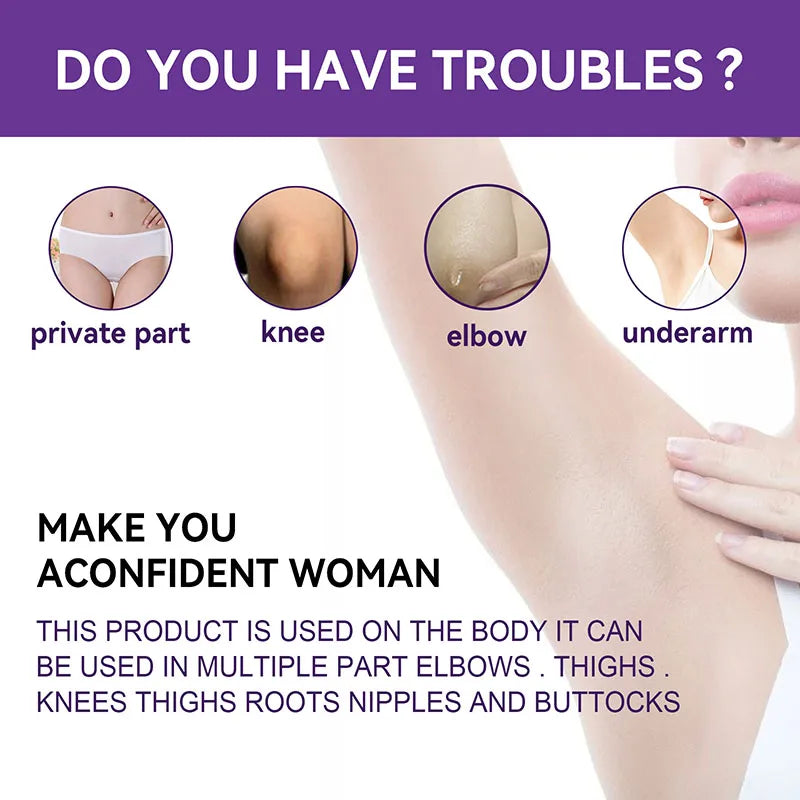 كريم تبييض الجسم للبشرة الداكنة والمناطق الحساسة، جوهر وردي لتفتيح البشرة الباهتة، مبيض الجمال والصحة للشحن المباشر 20 جرام