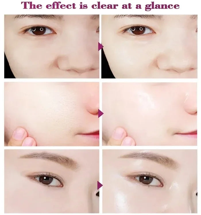 26 Skin Care Essence Minimizing Facial Pore Repairing Beauty Serum for Smoothing and Tightening Face; Minimize Pores