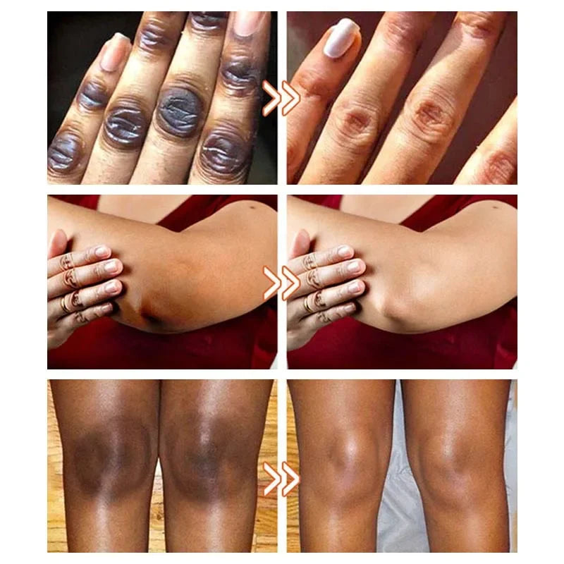 كريم تبييض المناطق الحساسة للجسم، مصل الجسم الوردي، تفتيح الميلانين، تحت الإبطين، الوركين، الفخذين الداخليين، تفتيح وإصلاح العناية بالأجزاء الخاصة