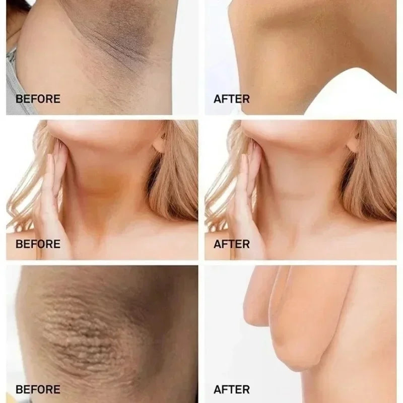 Body Moisturizing Underarm Whitening Cream Bleach Butt Knee Private Parts Melanin Brighten Lighten Dark Skin Care Women Beauty