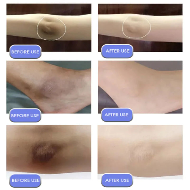 كريم تبييض الجسم للبشرة الداكنة والمناطق الحساسة، جوهر وردي لتفتيح البشرة الباهتة، مبيض الجمال والصحة للشحن المباشر 20 جرام