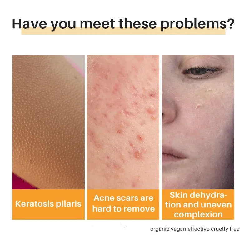 Body Whitening Soap Deep Clean Skin Chicken Skin Removal Soap Armpit Underarm Knees Bleaching Body Brighten White Care Products