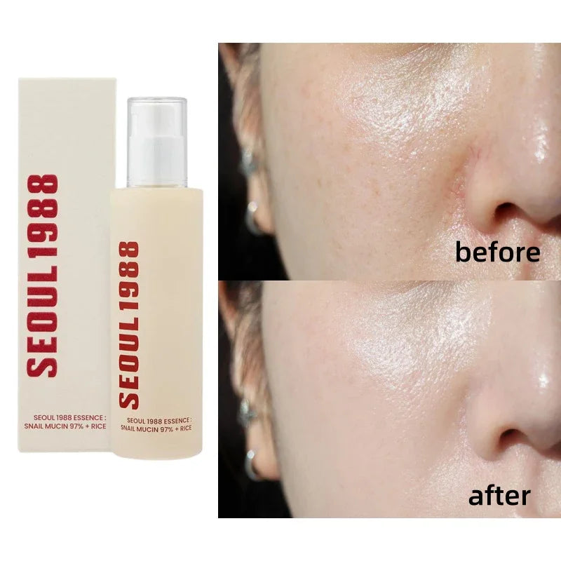 Korean Skin Care Set Seoul 1988 Eye Cream Snail Mucin Skincare Set Facial Sunscreen Cream Vitamin C Moisturizing Firming Essence