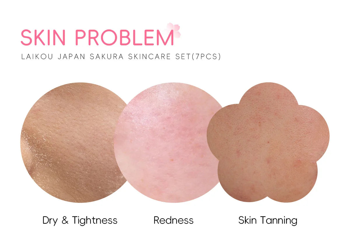 Sakura Skin Care Kit Hydrating Moisturizing Skin Care with Cleansing Pore Treatment and Sunscreen  Cosmetic  Skincare Korean