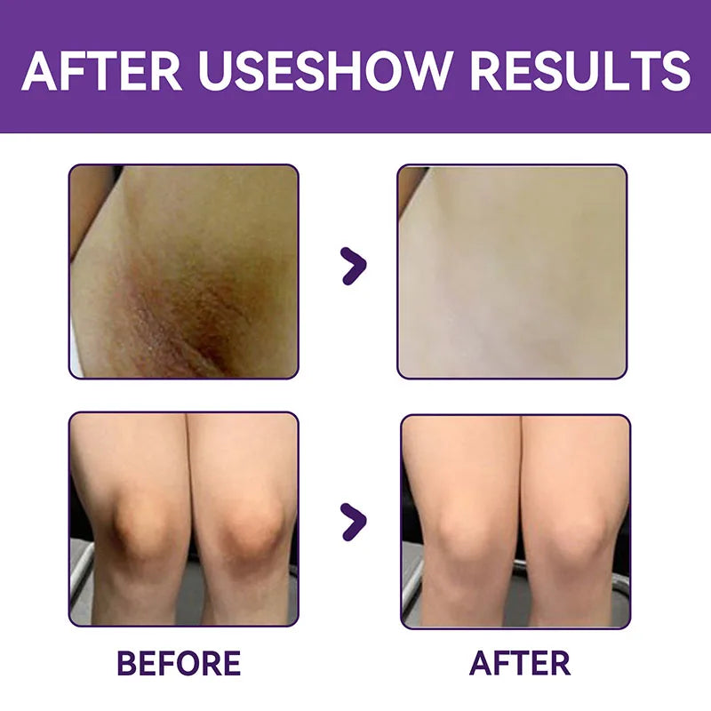 كريم تبييض الجسم للبشرة الداكنة والمناطق الحساسة، جوهر وردي لتفتيح البشرة الباهتة، مبيض الجمال والصحة للشحن المباشر 20 جرام