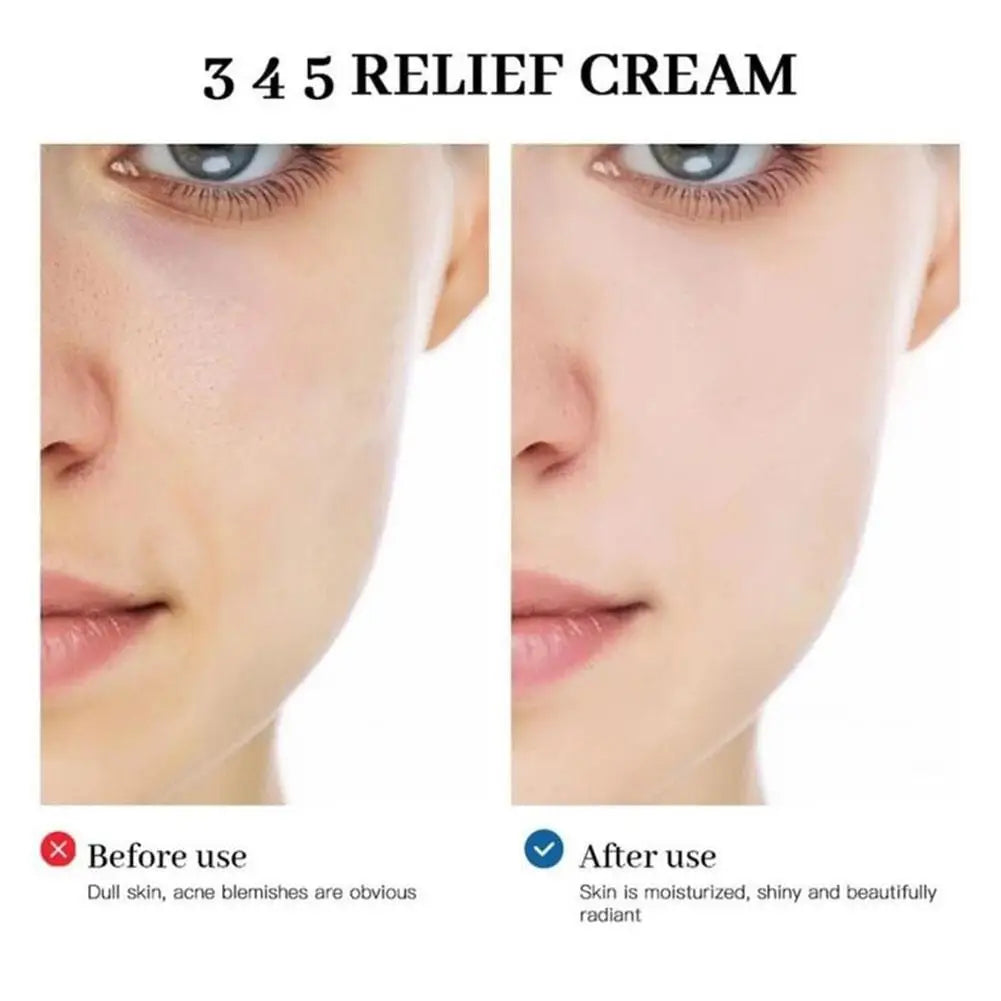 345 Relief Cream Korean Dr.Althea Antioxidant Relief Cream  Soothing Hydrating Repair Clean Acne For Oily Skin Care