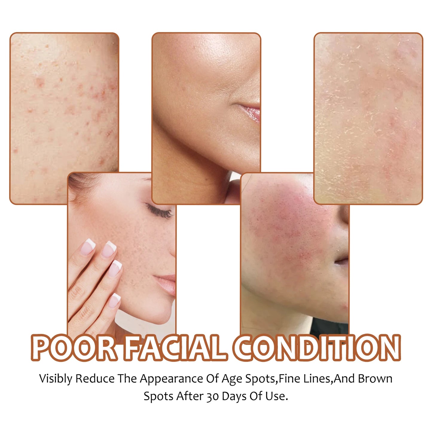 Facial Cleaning Handmade Soap Lemon Turmeric Kojic Acid Soap Deeply Cleansing Exfoliating Even Skin Tone Bathing Soap Skincare