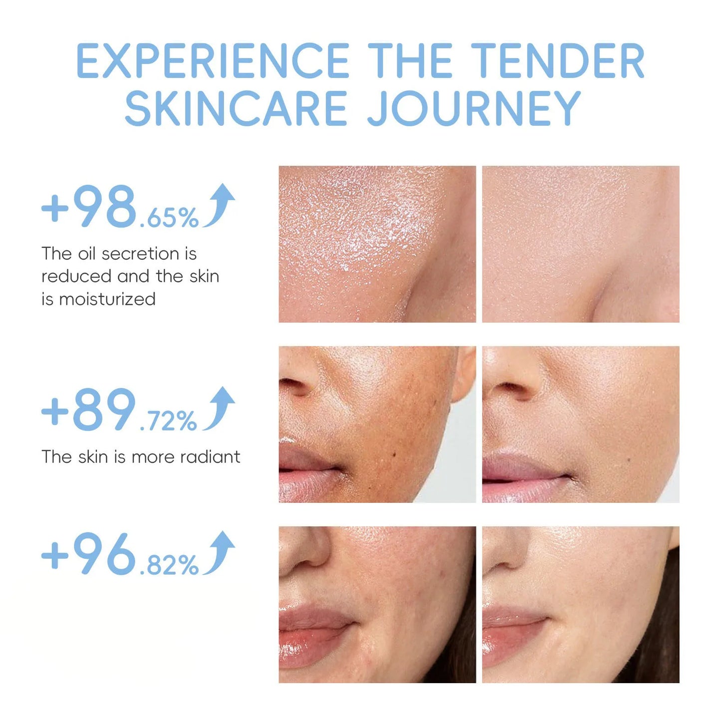 Milk Brightening 5-Piece Skincare Set - Hydrating & Brightening Includes Cleanser Toner Serum Eye Cream Moisturizer