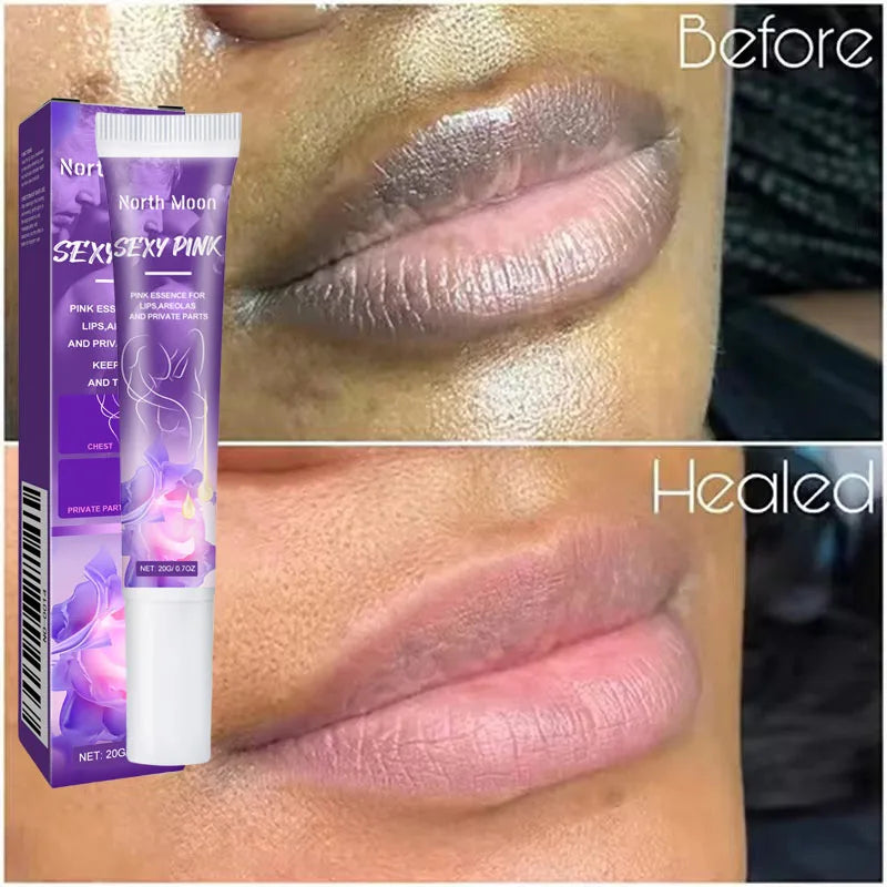 كريم تبييض الجسم للبشرة الداكنة والمناطق الحساسة، جوهر وردي لتفتيح البشرة الباهتة، مبيض الجمال والصحة للشحن المباشر 20 جرام