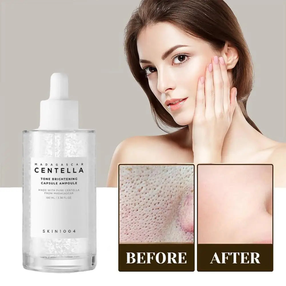 100ml Centella Asiatica Essence Hydrating Repairing Moisturizing Brightening Face Serum Daily Skin Care Solution