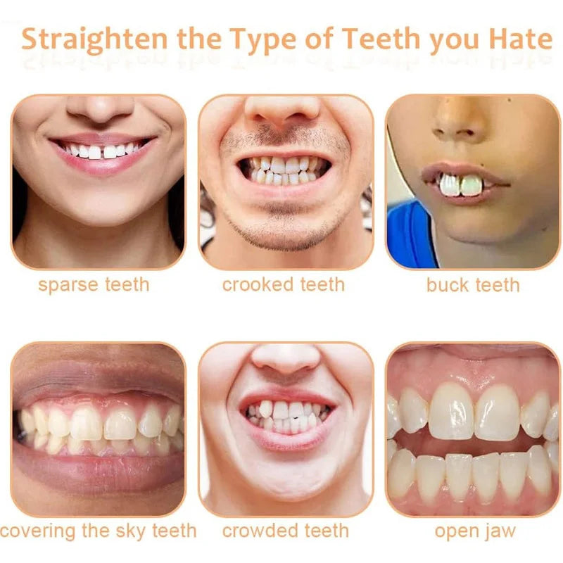 False Teeth Silicone Upper Lower Veneers Perfect Denture Silicone Kit Temporary Orthodontic Fake Tooth Oral Hygiene Care