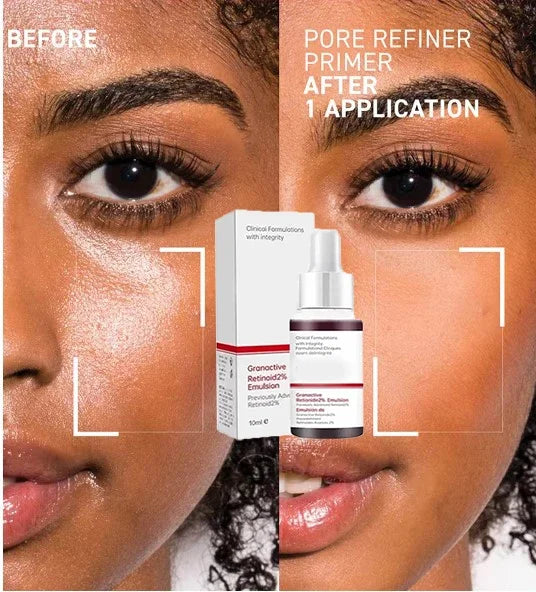 26 Skin Care Essence Minimizing Facial Pore Repairing Beauty Serum for Smoothing and Tightening Face; Minimize Pores