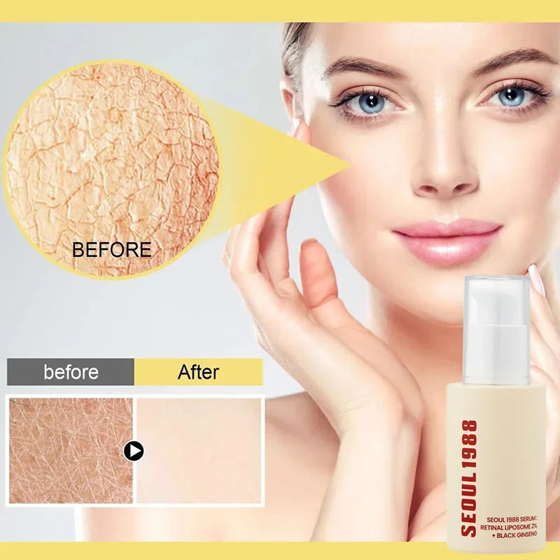 Korean Skin Care Set Seoul 1988 Eye Cream Snail Mucin Skincare Set Facial Sunscreen Cream Vitamin C Moisturizing Firming Essence