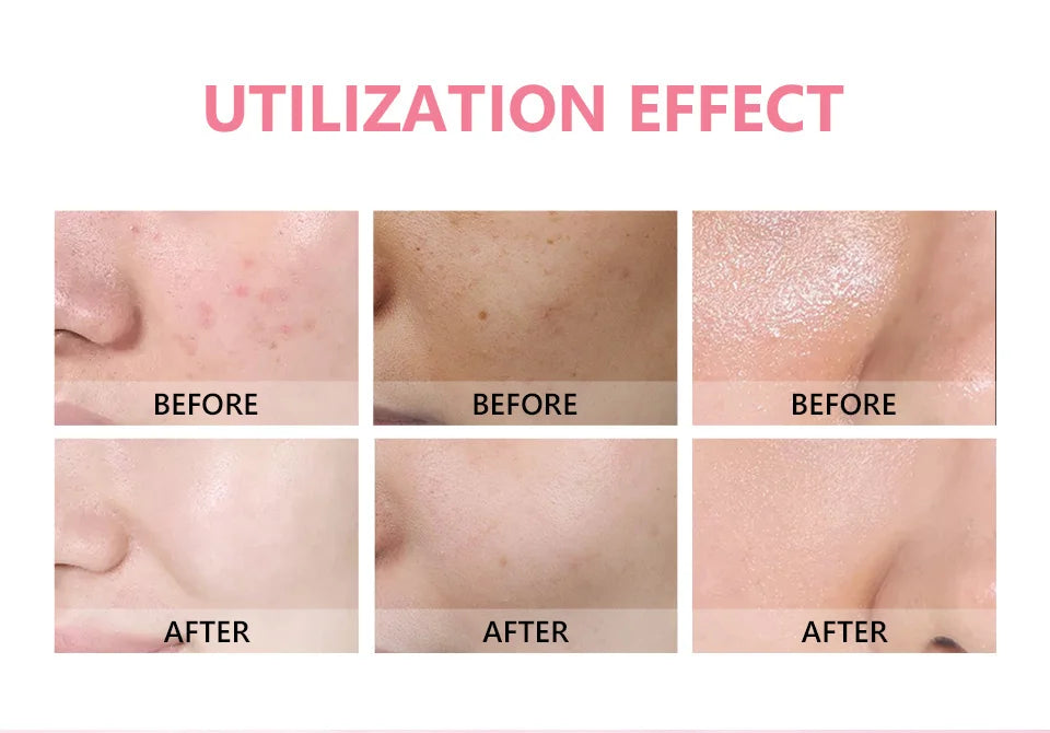 كريم ترطيب الوجه من Bubbles للعناية بالبشرة، كريم ترطيب الوجه من Bubbles، كريم تبييض البشرة الأصلي من Niacinist للعناية الشخصية والجمال