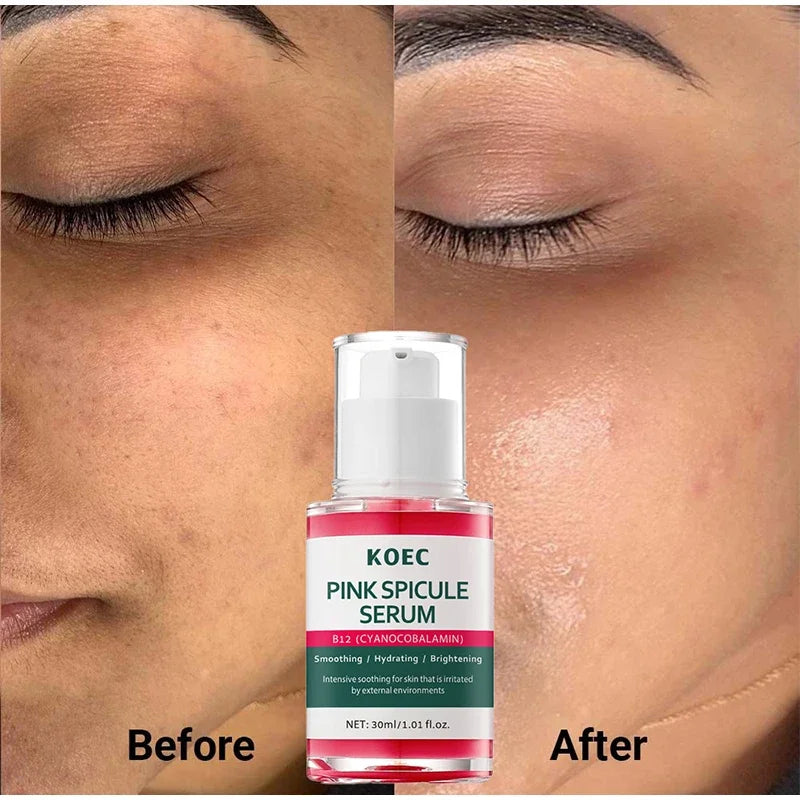 Facial Skin Care Essence Delicate Pores Moisturizing Nourish Dull Hydrating Protecting Skin Bright Revitalizing Unisex Essence