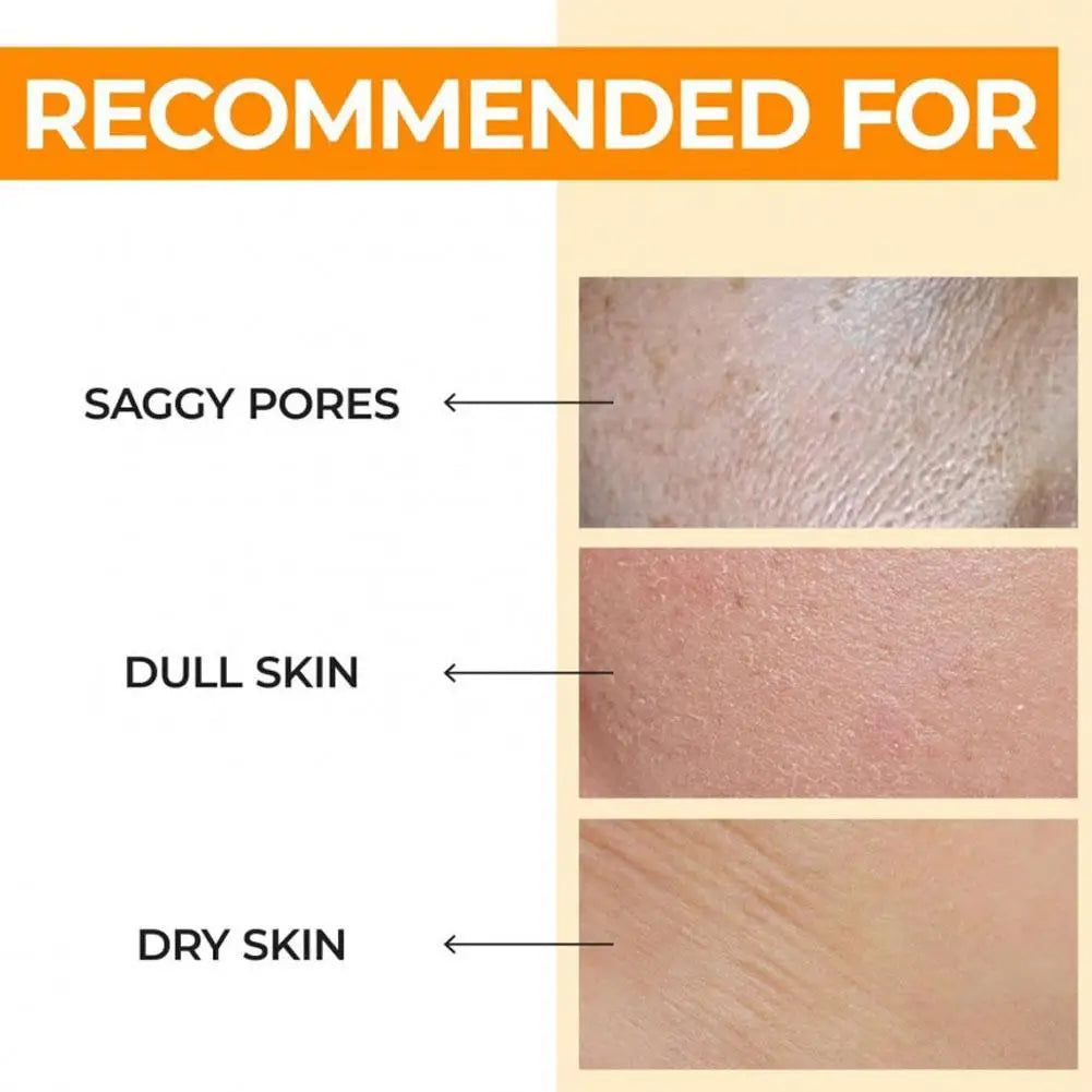 Skin Care Package (Skin Cream+Toner+Facial Essence) Deeply Improve Rough And Delicate Skin Of Pores Enhance Skin Elasticity