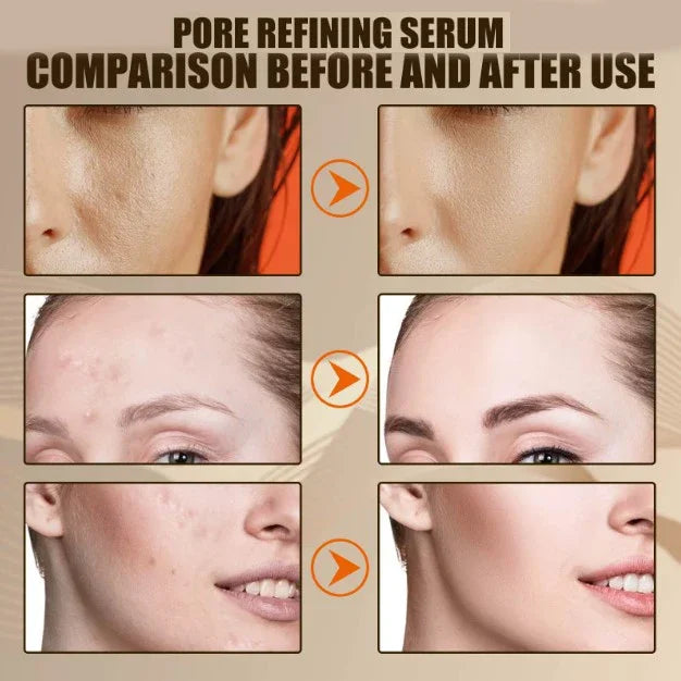 26 Skin Care Essence Minimizing Facial Pore Repairing Beauty Serum for Smoothing and Tightening Face; Minimize Pores